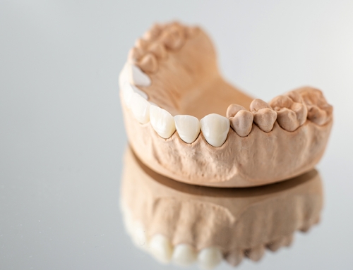 Dental Crowns in Katy and Cypress Texas