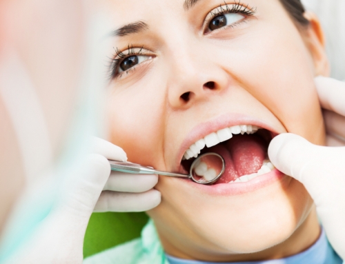 Fillings in Cypress, Texas