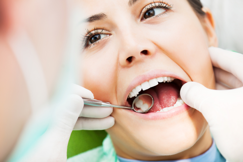 Fillings in Katy, Texas