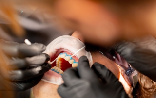 restorative dental in cypress