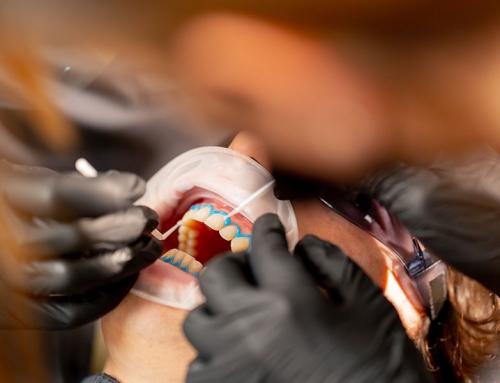 Restorative Dentistry in Cypress, TX