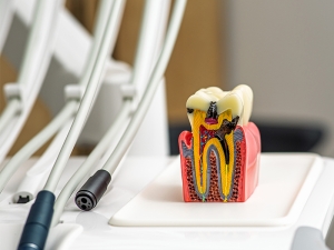 root canal cypress texas