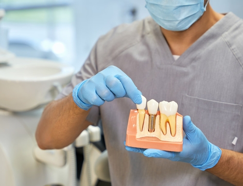 Not Sure About Dental Implants? 3 Things to Consider