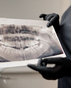 Advanced dental technology at Katy tx dentist – Welch Dental Group